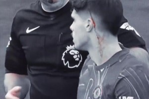 别破我记录！名场面：大罗的颠橙子挑战，被萨莫拉诺破坏！